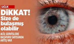 Sizde de olabilir! Adenovirüs semptomlarına dikkat