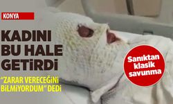 Konya’da duruşma başladı! Genç kadının yüzüne yanıcı sıvı atan sanıktan klasik savunma
