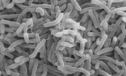 Sağlık Bakanlığı'ndan "Vibrio" Açıklaması: Türkiye’de Vaka Yok