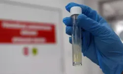 Tüberküloz, Dünyanın En Ölümcül Bulaşıcı Hastalığı Olmayı Sürdürüyor