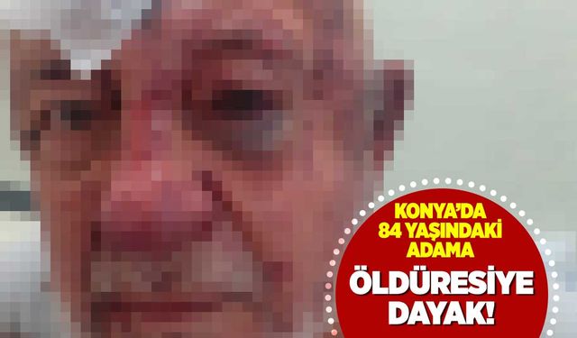 Kim bunlar? 84 yaşındaki vakıf başkanına öldüresiye dayak