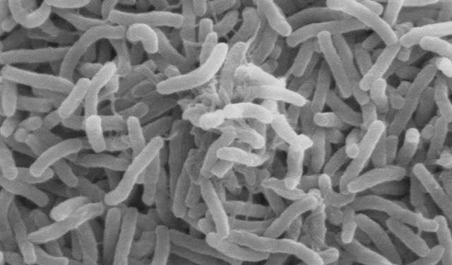 Sağlık Bakanlığı'ndan "Vibrio" Açıklaması: Türkiye’de Vaka Yok