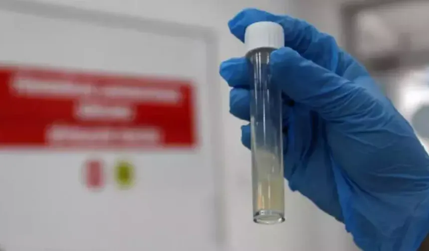 Tüberküloz, Dünyanın En Ölümcül Bulaşıcı Hastalığı Olmayı Sürdürüyor